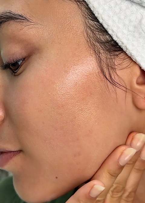 After - hydrated, dewy, glowing skin