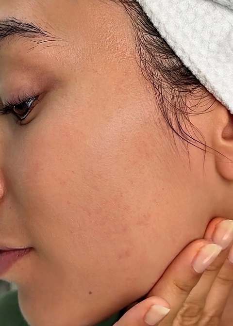 Before - matte, dry-looking skin